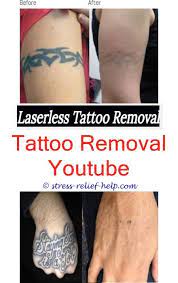 Tattoo Lightening Does Laser Tattoo Removal Cream Work How To Remove Permanent Tattoo From Body At Home T Lightening Tattoo Tattoo Removal Cream Laser Tattoo