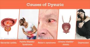 Image result for Dysuria