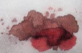 Comment Nettoyer Une Tache De Sang Seche Enlever Tache De Sang Tache De Sang Nettoyer Tache De Sang