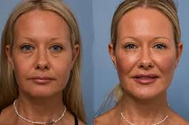 All-Time All-Tidewater Football Teams (1932-present)