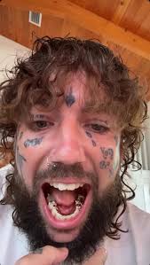 Lmao Scrim said “my teeth might be cooked but they 24 karat gold cooked” 🤣