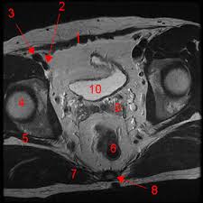 Check spelling or type a new query. Male Pelvis Magnetic Resonance Imaging W Radiology