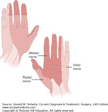 Image result for phlegmon of hand)