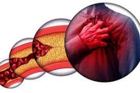 Maybe you would like to learn more about one of these? Dieta Pri Vysokom Cholesterole Jedalnicek Tip Na Recepty Imunita Online
