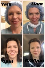 CASS Teammate and excellent CRNA Clint Norris practicing @ Roxy Plastic  Surgery.💪🏻💪🏻💪🏻