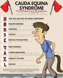 The more quickly treatment (via surgical decompression of the spinal cord) is received. Facebook