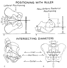 Presentation And Mechanisms Of Labor Glowm