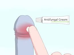3 Simple Ways To Pull Your Foreskin Back Without Pain - Wikihow