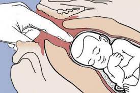 Vital Info On Stripping Membranes To Induce Labor Lovetoknow