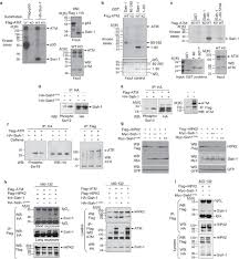 Wet n wild fergie shimmer palette. Control Of Hipk2 Stability By Ubiquitin Ligase Siah 1 And Checkpoint Kinases Atm And Atr Nature Cell Biology