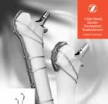 Cable-Ready® Cable Grip System