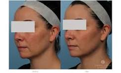 Image result