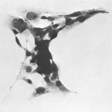 Image result for CSF Culture