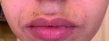 Based on 133 recent ratings. 25 Unique Hair Removal Products