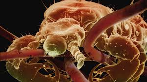 As Lice Grow Treatment Resistant Drug Could Help Npr Find & download free graphic resources for lice. as lice grow treatment resistant drug