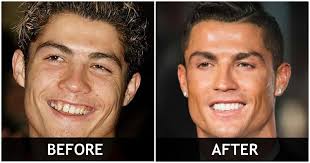 Celebrities with braces archives | montano & cardall orthodontic specialists. Before After Pictures Of Celebrities Who Have Had Their Teeth Done Being Dad