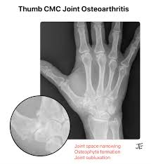 Image result for Hand XRay
