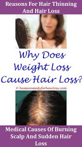 Hair Loss Dog Excessive Hair Loss Cause Dermatologist Specializing In Hair Loss Toronto Hormone Ranges In Females Help Hair Loss Excessive Hair Loss Hair Loss