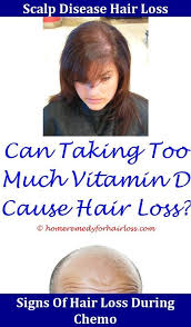 How To Make Your Hair Thicker Vitamins For Growing Thicker And Fuller Hair Hair Loss Hair Loss In Children Hair Loss Men