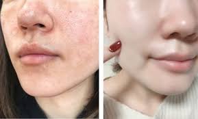 pluest プルエスト 肌 綺麗 美容 スキンケア