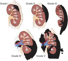 Image result for Genitourinary Trauma