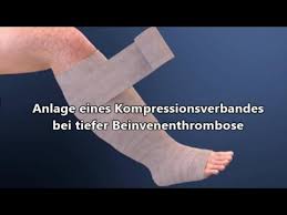 Kompressionsverband Bei Thrombose Youtube