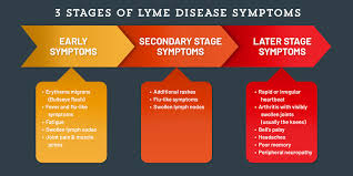 Signs Of Lyme Disease Tick Borne Diseases Tick Protection