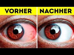 10 Simple Ubungen Die Mude Augen Munter Machen Youtube