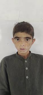 So, I need to lose weight...V difficult when you have Porphorya. However  there is something called the potato diet, obviously full of carbs. That's  it!..potatoes and potatos only. Want to try it