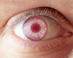 Closeup Of A Red Eye Rare Eye Colors Rare Eyes Cool Eyes