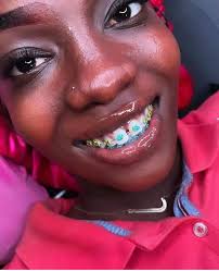 Ask us anything about braces, teethwhitening and dental procedures. Call  027 362 8321