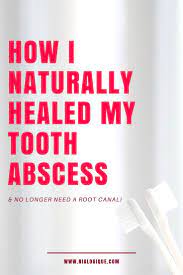 How I Naturally Healed A Tooth Abscess And Avoided A Root Canal Procedure Root Canal Holistic Health Remedies Tooth Infection