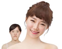 Hospital sungai buloh is located about 25km from kuala lumpur at mukim batu, daerah gombak, selangor. Plastic Surgery In Korea Id Hospital Asia Beauty Center