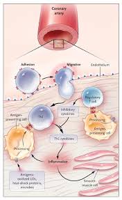 Inflammation Atherosclerosis And Coronary Artery Disease Nejm
