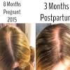 In just two to three sessions, you can have the look of your full head of hair back, forever. 3