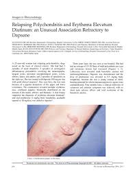 Image result for Relapsing Polychondritis
