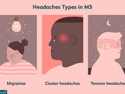 People who have these headaches often. Headaches In Ms Types Symptoms Causes Diagnosis Treatments