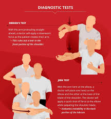 Image result for Shoulder Exam