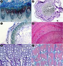 Image result for Afroligusticum