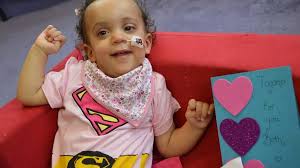 Tragic Derby toddler Eva-Rose is unlikely to live until she's two