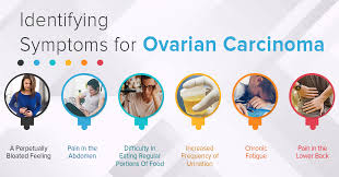 Abdominal bloating, difficulty eating, early satiety, nausea, vomiting, or constipation: Ovarian Cancer A No More A Silent Killer Advanced Cancer Treatment Centers