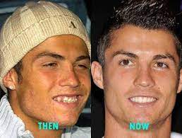 Cristiano ronaldo was angry because they put coca cola in front of him at the portugal press conference, instead of water! Cristiano Ronaldo Plastic Surgery Before And After Celebrity Plastic Surgery Plastic Surgery Kylie Jenner Plastic Surgery