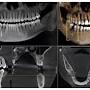 "Oriente", Radiología Dental from odontolabx.com.co