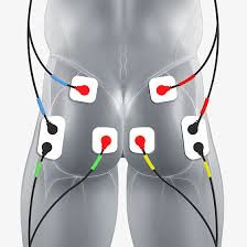 glutes electrode pad placement compex electrode placement