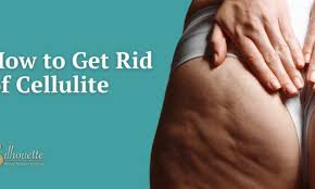 How to Get Rid of Cellulite | QWO Cellulite Treatment in Bakersfield