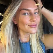 Affordable dental veneers in Colombia