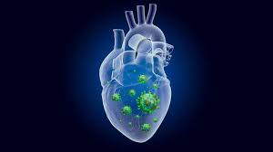 Myocarditis is the term used to describe the acute infective, autoimmune, or toxic inflammation of the heart muscle, which is also known as myocardium. Coronavirus Minuto A Minuto El Covid 19 Ataca El Corazon De Jovenes Asintomaticos Tyn Magazine
