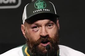 Tyson Fury announces retirement from boxing with cryptic message