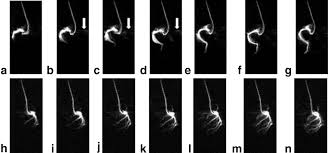 Welche orte liegen im umkreis von mainz? Mr Coronary Angiography In Pigs With Intraarterial Injections Of A Hyperpolarized 13c Substance Olsson 2006 Magnetic Resonance In Medicine Wiley Online Library