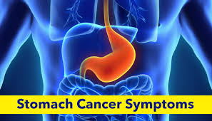 The stomach is a muscular sac located in the upper middle of your abdomen, just below your ribs. Stomach Cancer Symptoms Best Gastro Surgeon Ahmedabad Best Gatroenterologist Ahmedabad Best Liver Surgeon Ahmedabad Liver Surgery Ahmedabad Best Liver Surgeon Ahmedabad Weight Loss Clinic Ahmedabad Best Weight Loss Clinic Ahmedabad Best